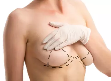 What is Breast Uplift?