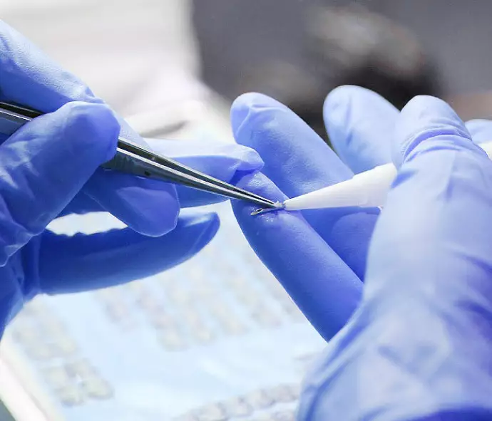 DHI Hair Transplant