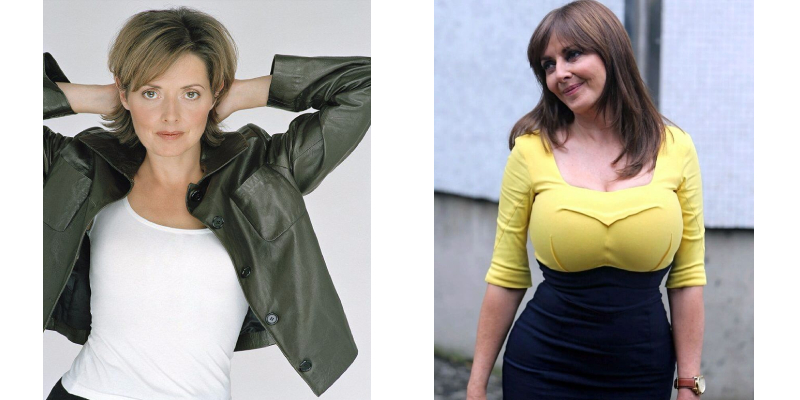 Carol Vorderman Boob Job