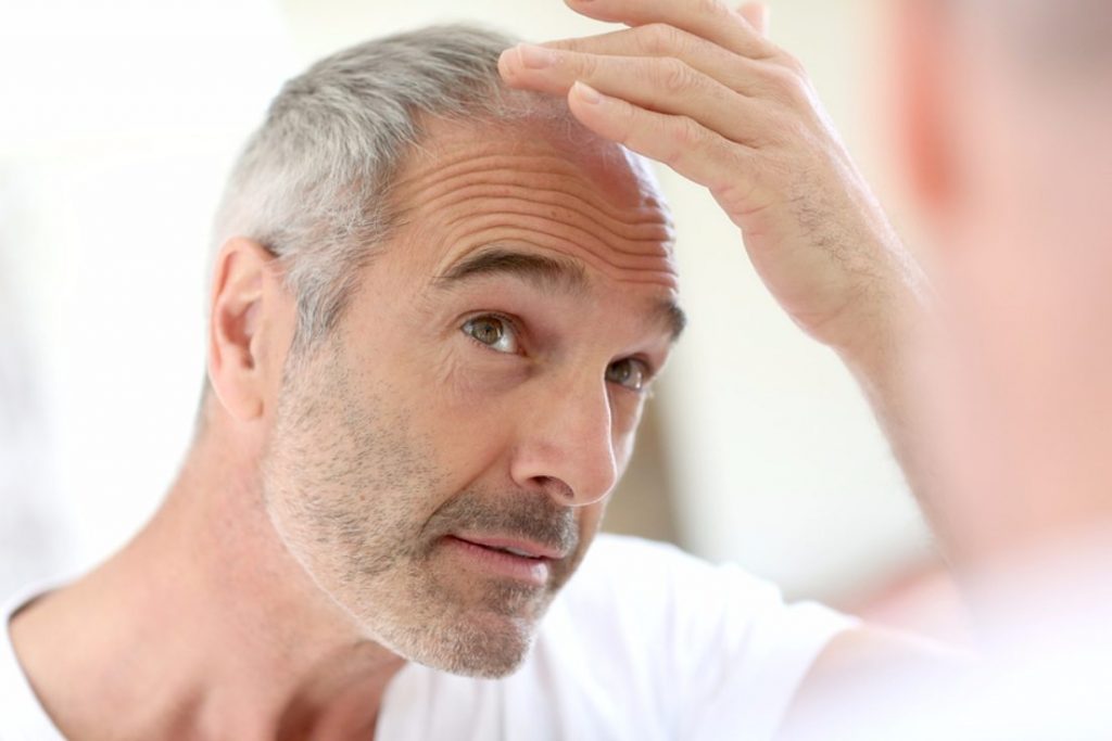 Hair Transplantation Turkey - MCAN Health