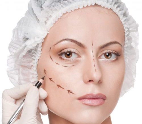 Facelift (Rhytidectomy) Turkey | MCAN Health Facelift (Rhytidectomy) Turkey | MCAN Health