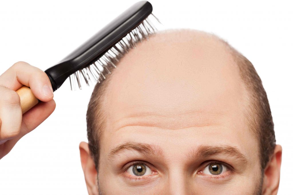 Mcan Health PRP Treatment