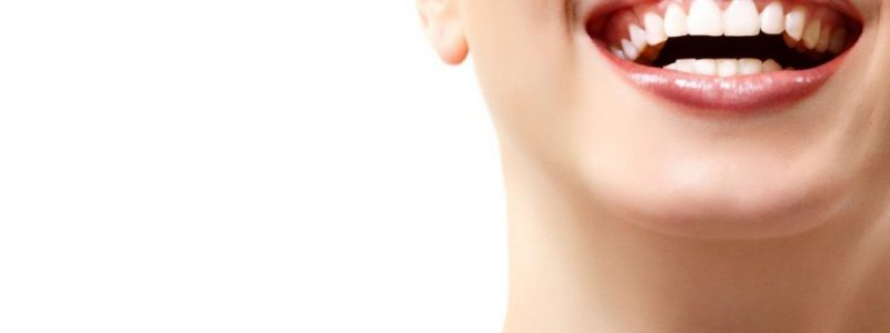 Zahnweißung in der Türkei | MCAN Health Zahnweißung mit MCAN Health Türkei