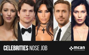 celebrities nose job