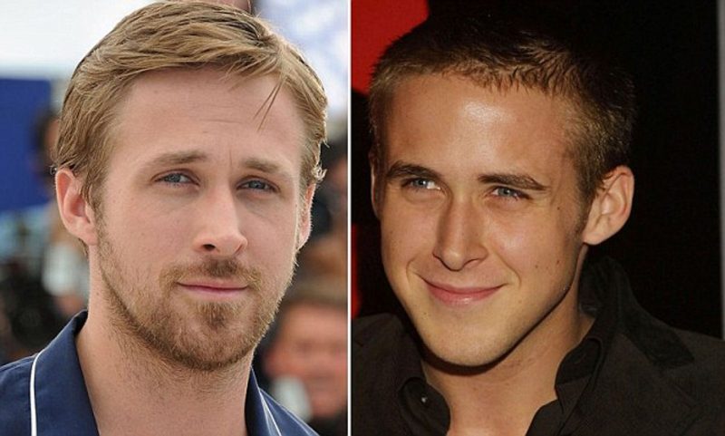 Ryan Gosling Nose Job 