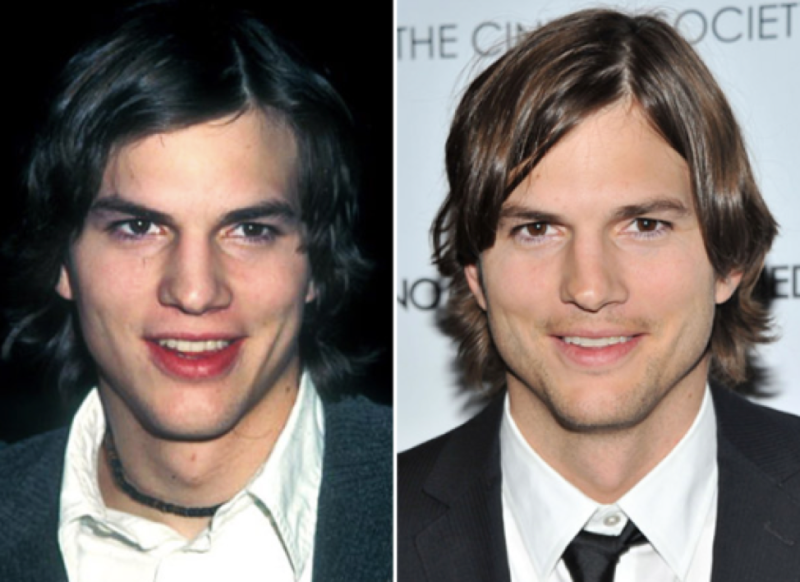 Ashton Kutcher nose job