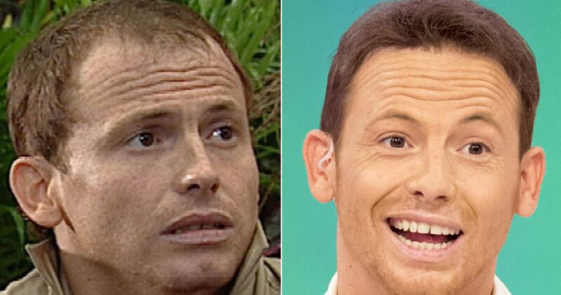 Celebrity Hair Transplant Stories and Before and After Photos 12 joe swash e1640783486255 famous people hair transplant- joe swash