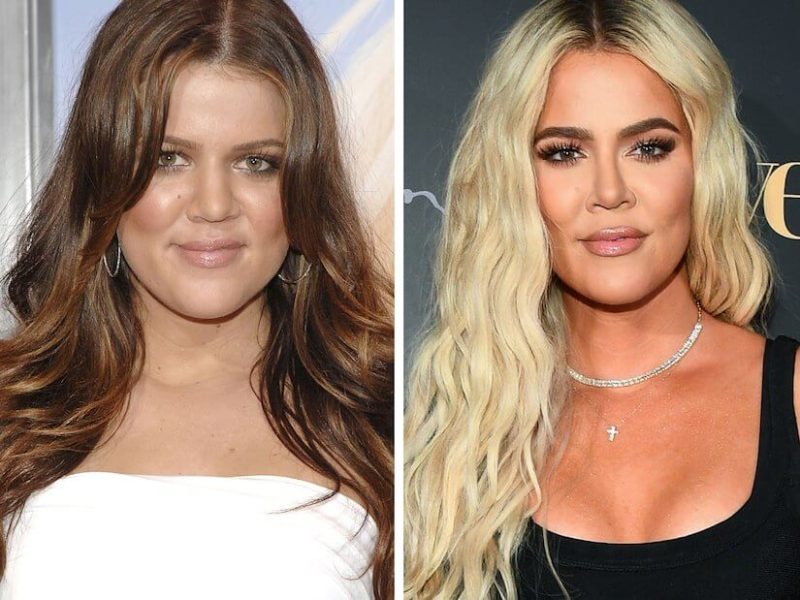 Khloe Kardashian Nose Job 