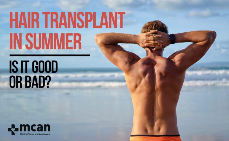 Hair Transplant In Summer, Is It Good or Bad? 17 Hair transplant in summer Hair Transplant In Summer