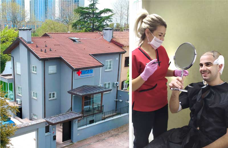 10 Things to Consider Before Hair Transplant 7 A Trusted Reputable Hair Clinic Mcan Hair Clinic view and before hair transplant operation consultation