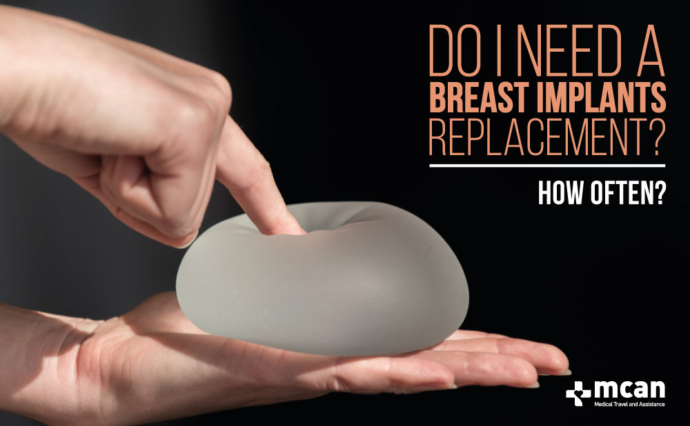 breast implants replacement