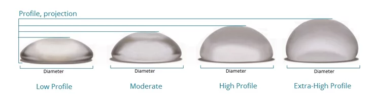 profiles breast implant projection