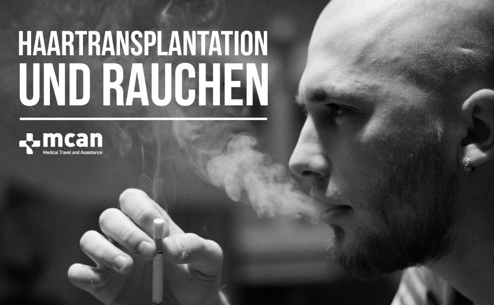 Haartransplantation und Rauchen