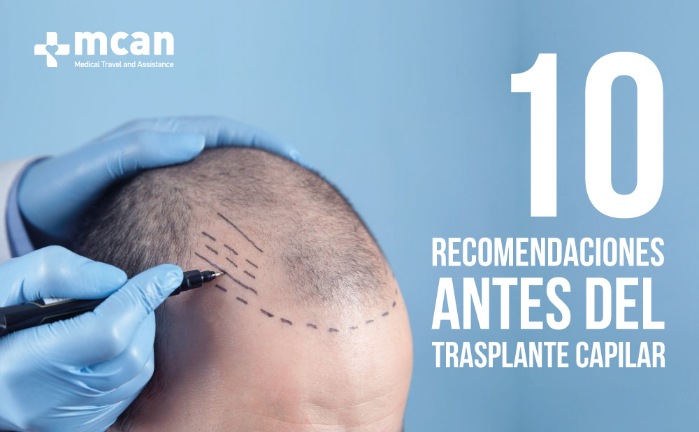 recomendaciones antes del trasplante capilar | MCAN Health