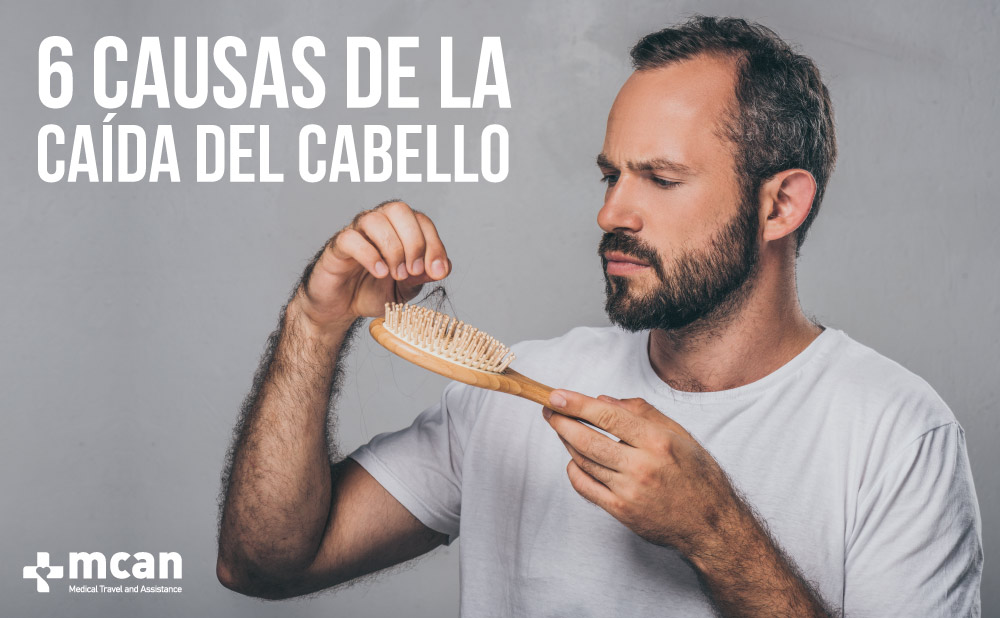 Causas de la caída del cabello | MCAN Health