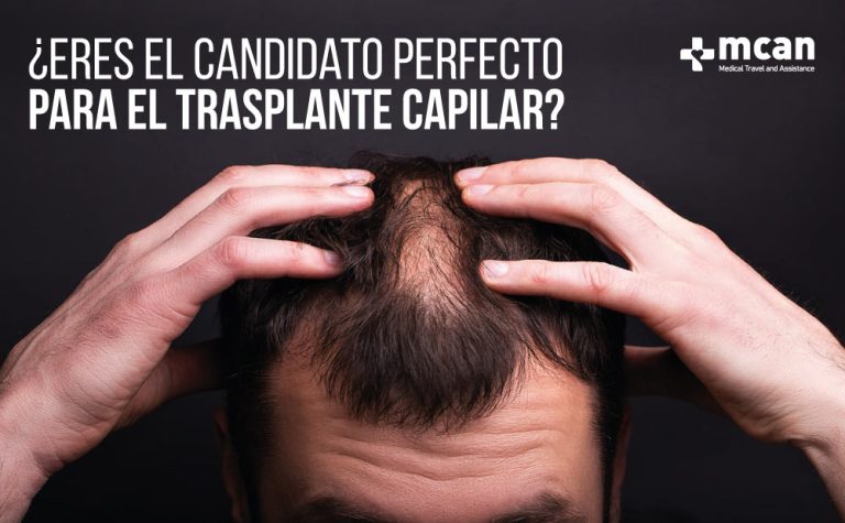¿Eres el Candidato Perfecto para un Injerto Capilar? 4 ¿Eres el candidato perfecto para el trasplante capilar Candidato perfecto para el injerto capilar | MCAN Health Blog
