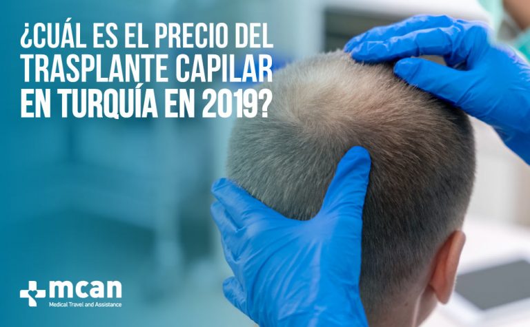 ¿Cuál es el Precio del Trasplante Capilar en Turquía? 3 Cual Cual