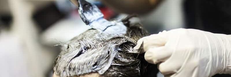 A man is having his hair dyed after hair transplant