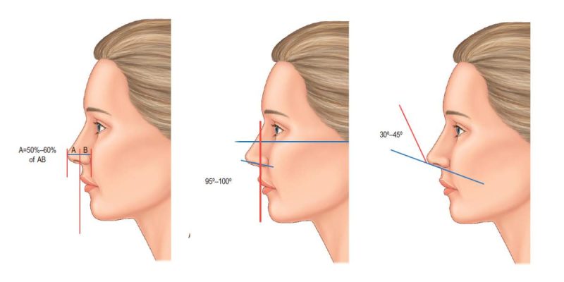 The Ideal Rotation Angle of the Nose