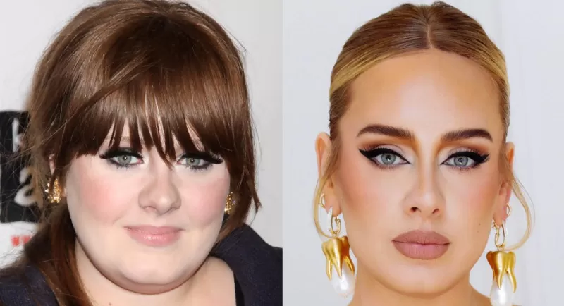 Adele nose job