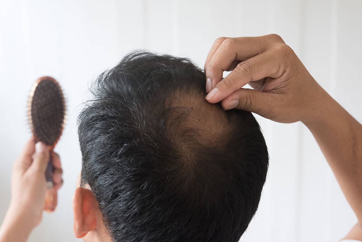 Estrés: una de causas de la caída del cabello | MCAN Health