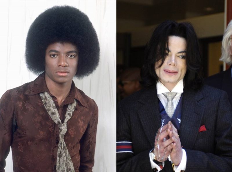 Michael Jackson Nose 