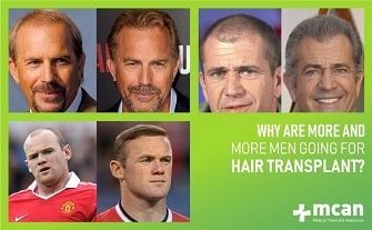 Why Are More And More Men Going For Hair Transplant Mcan Health