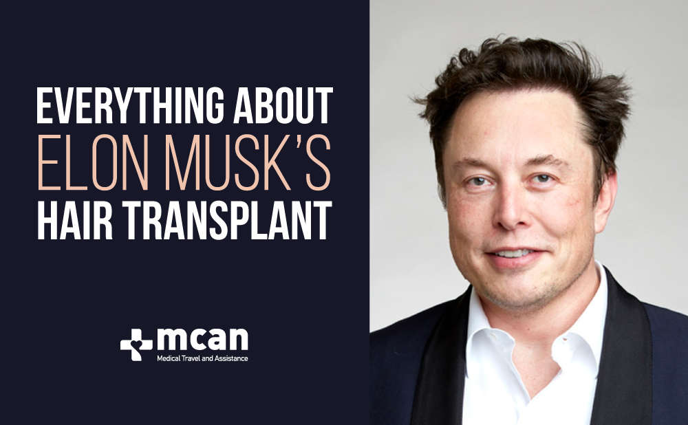 Everything About Elon Musk’s Hair Transplant