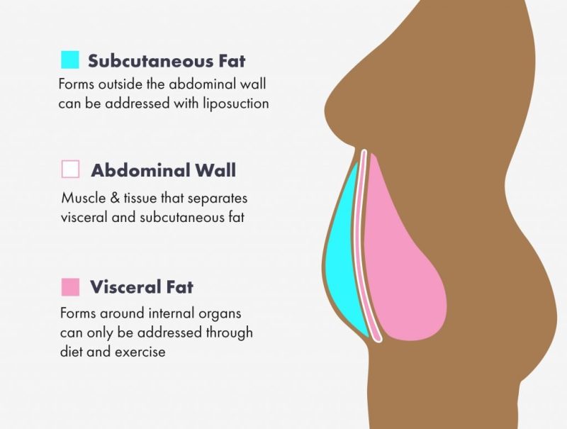 Visceral Fat and Subcutaneous Fat