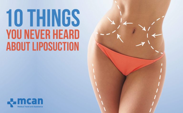 10 Things You Never Heard About Liposuction 12 liposuction things to know 10 Things You Never Heard About Liposuction