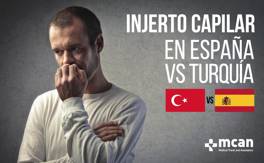 Injerto capilar en España o Turquía | MCAN Health