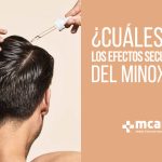 Efectos secundarios del Minoxidil | MCAN Health