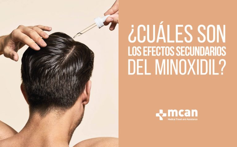 Efectos secundarios del Minoxidil | MCAN Health