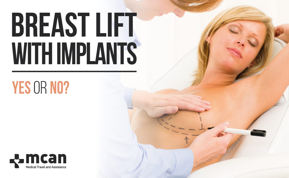 breast lift with implants