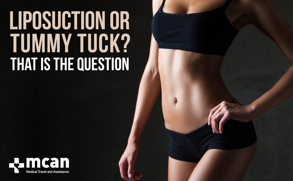 Liposuction and Tummy Tuck? That Is the Question