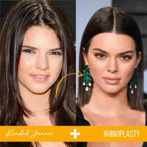 Most Popular Plastic Surgery Treatments 2019 Mcan Health
