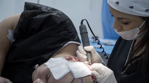 Implante Capilar Turquía en primavera