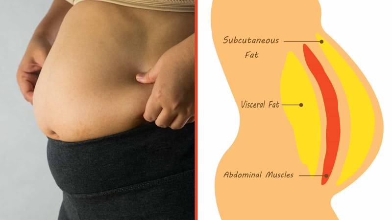 BBL uses your own natural belly fat