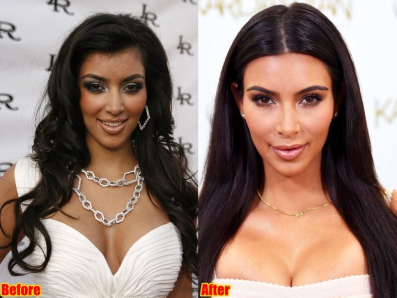 Kim Kardashian before plastic surgery