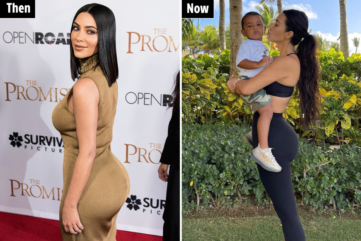 Kim kardashian before and after bbl removal 