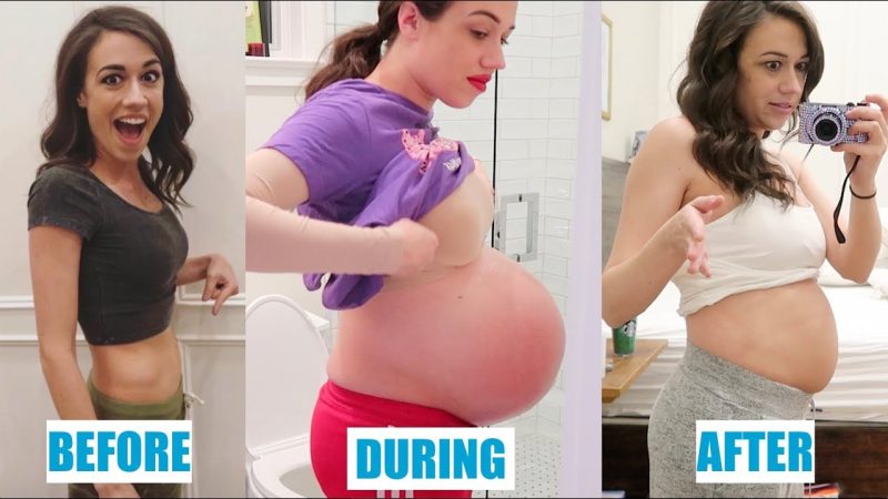 When is the right time for pregnancy and plastic surgery?!