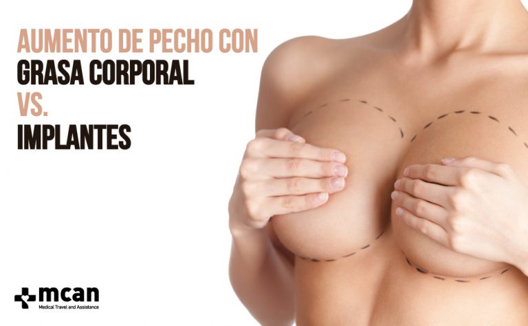 Aumento de Pecho con Grasa Corporal vs. Implantes 1 Aumento de pecho Aumento de pecho