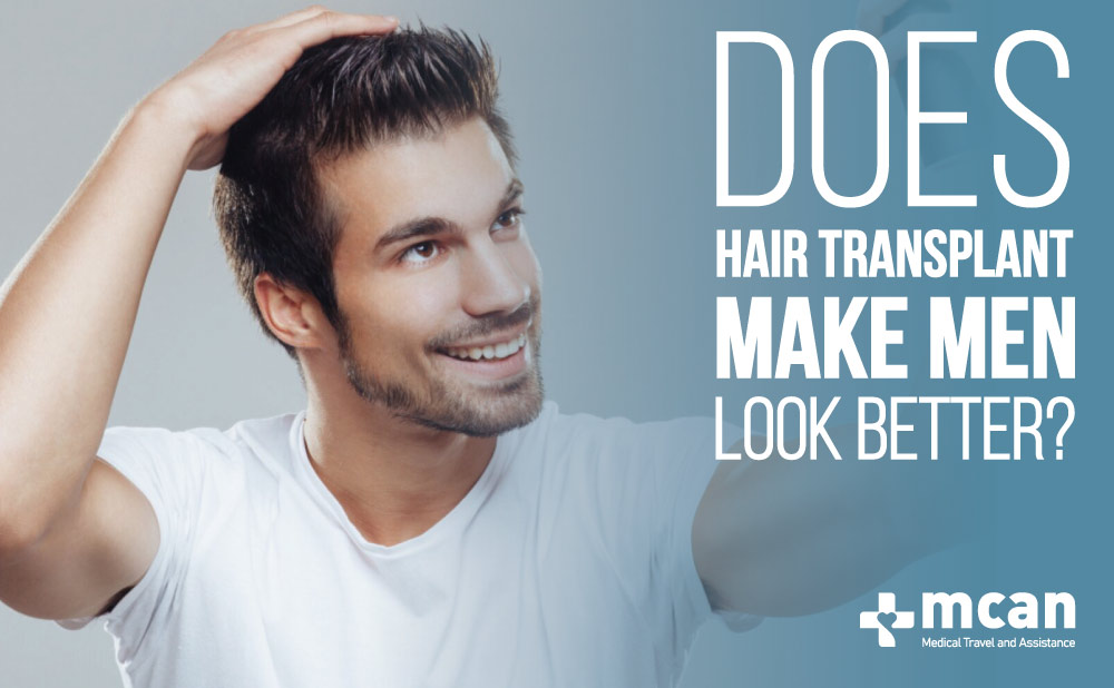 Does Hair Transplant Make Men Look Better?