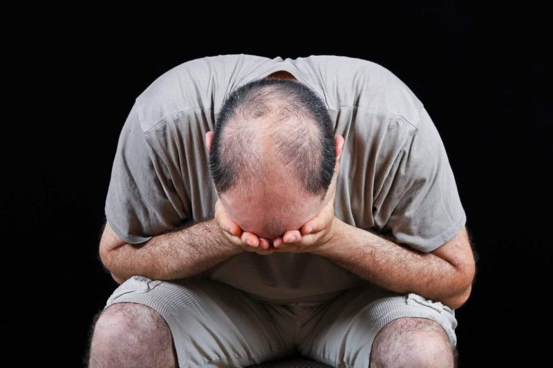 Hair Loss Depression 