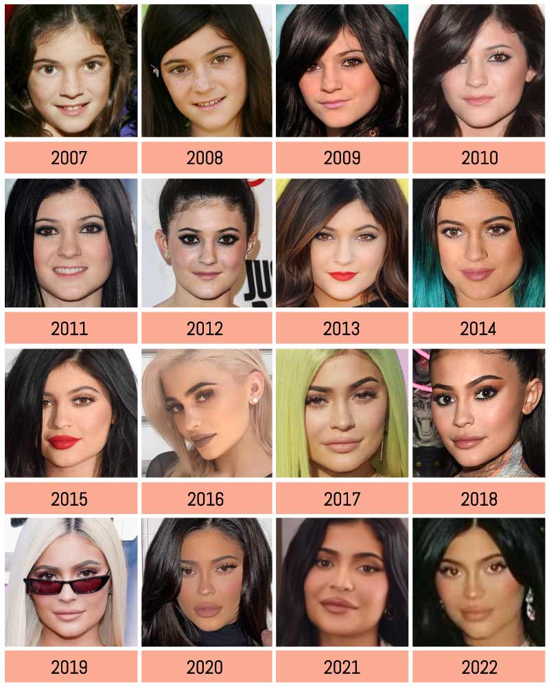 Kylie Jenner's face along the years
