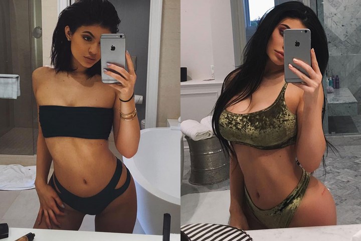 kylie before and after Kyliye Jenner Before and After Boob Job