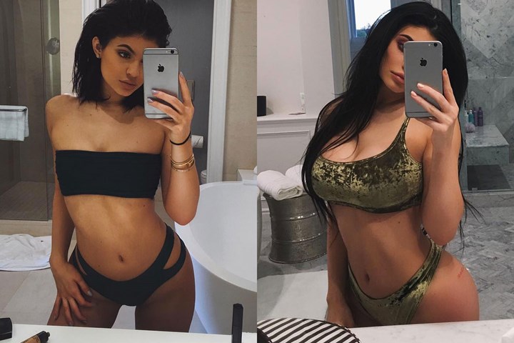 Kyliye Jenner Before and After Boob Job