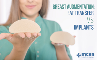 breast augmentation fat transfer vs implants blog