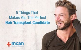 five things that makes you the perfect hair transplant candidate blog