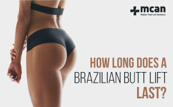 how long does a brazilian butt lift last blog